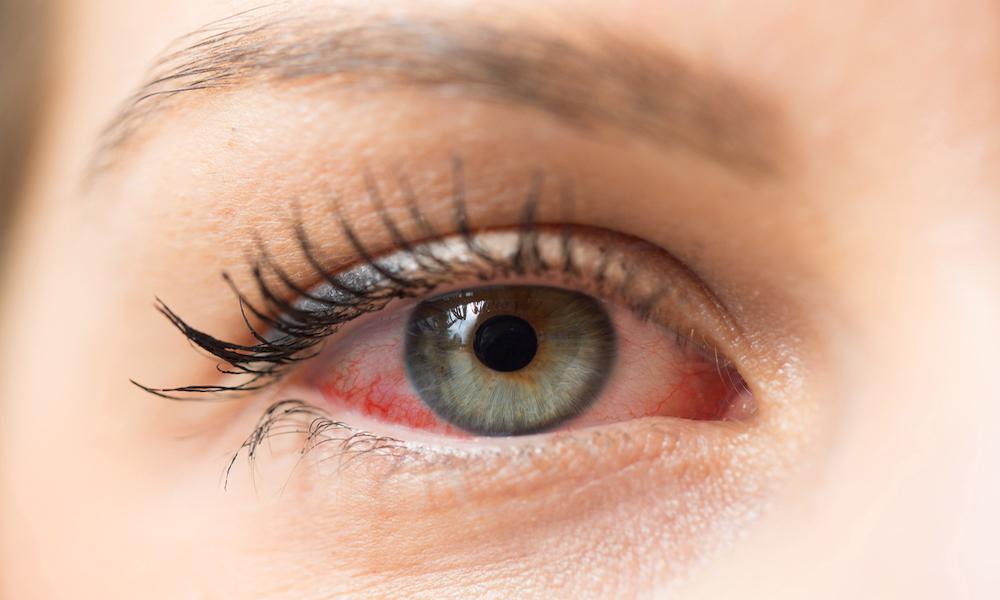 eye